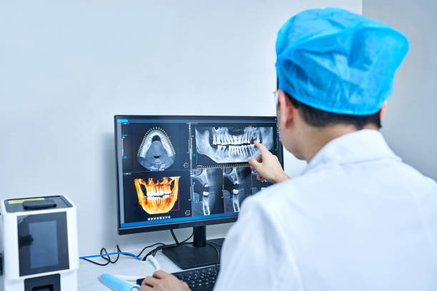 Best Emergency Dental Extractions in Marion, AL